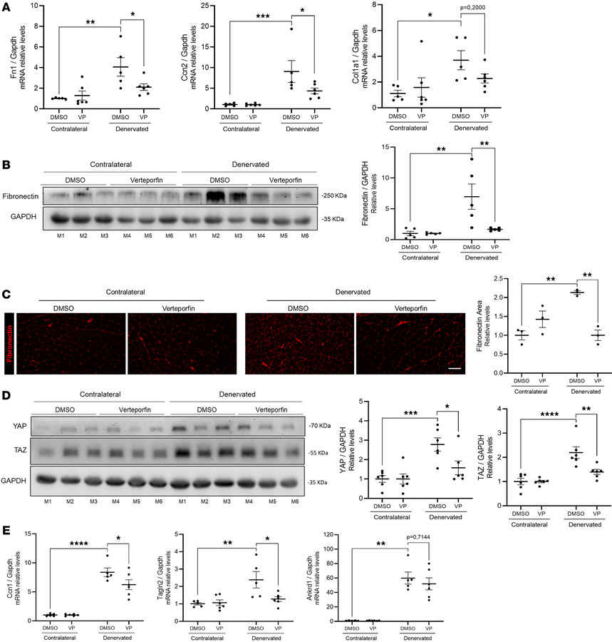 YAP/TAZ activity is required for denervation-induced skeletal muscle fib...
