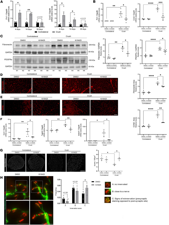 Inhibition of LPA1 and LPA3 reduces fibrosis and improves sciatic nerve ...