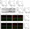 Pharmacological inhibition of LPA1 and LPA3 reduces the fibrotic response a