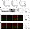 Lpar1 ablation prevents the skeletal muscle fibrotic response to denervatio