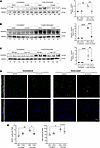 LPA1 is required for FAP increase after denervation.