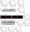 YAP/TAZ activity is required for denervation-induced skeletal muscle fibros