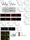 Inhibition of LPA1 and LPA3 reduces fibrosis and improves sciatic nerve int