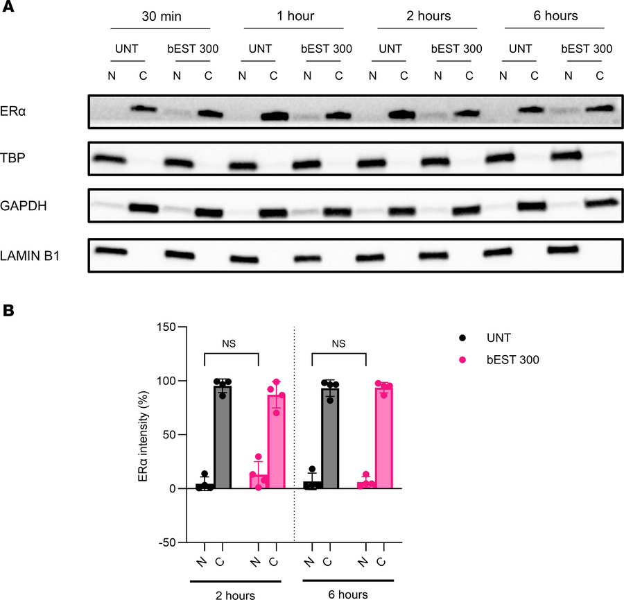 Absence of ERα protein nuclear localization and translocation in CD4+ T ...