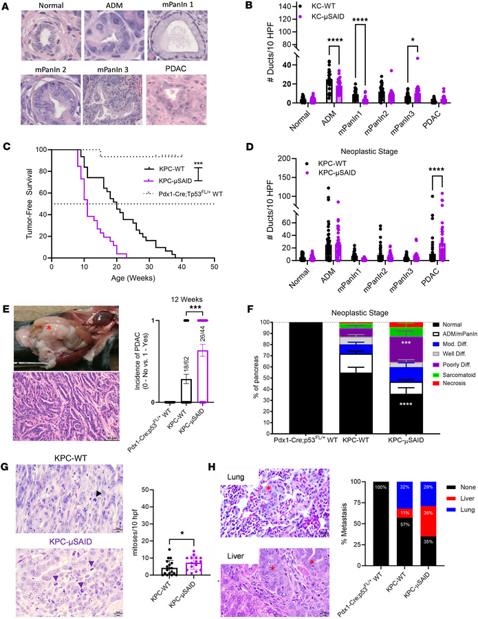 Antibody deficiency accelerates tumorigenesis in the KC and KPC models o...