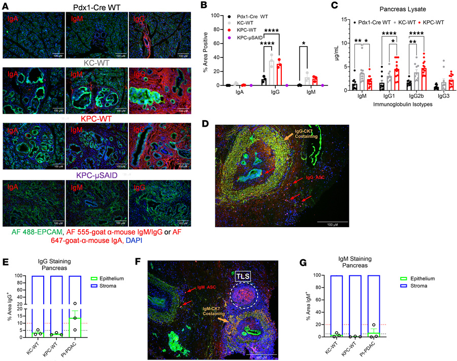 Localization of IgG antibodies to the pancreatic ECM and epithelia of mo...