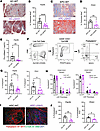 Antibody deficiency reduces ECM and CAF in the KC and KPC pancreatic microe