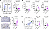 Antibody deficiency alters recruitment and phenotype of myeloid cells in th