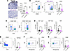 Antibody deficiency alters recruitment of T cell and NK cells in the pancre