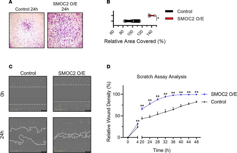 Ectopic expression of SMOC2 increases the motility of proximal tubular e...
