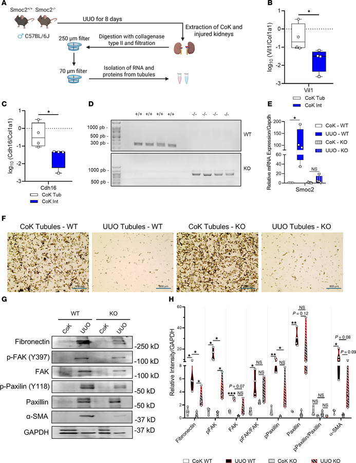 SMOC2 regulates integrin signaling and pEMT in mice undergoing UUO.
(A) ...