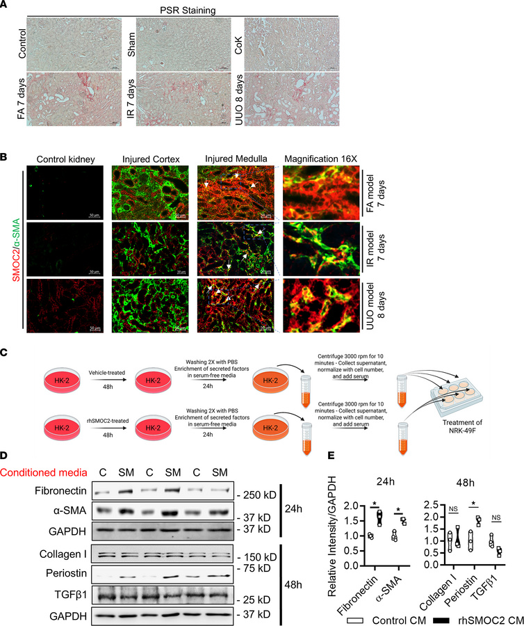 SMOC2 promotes an epithelial-fibroblast crosstalk during fibrogenesis.
(...