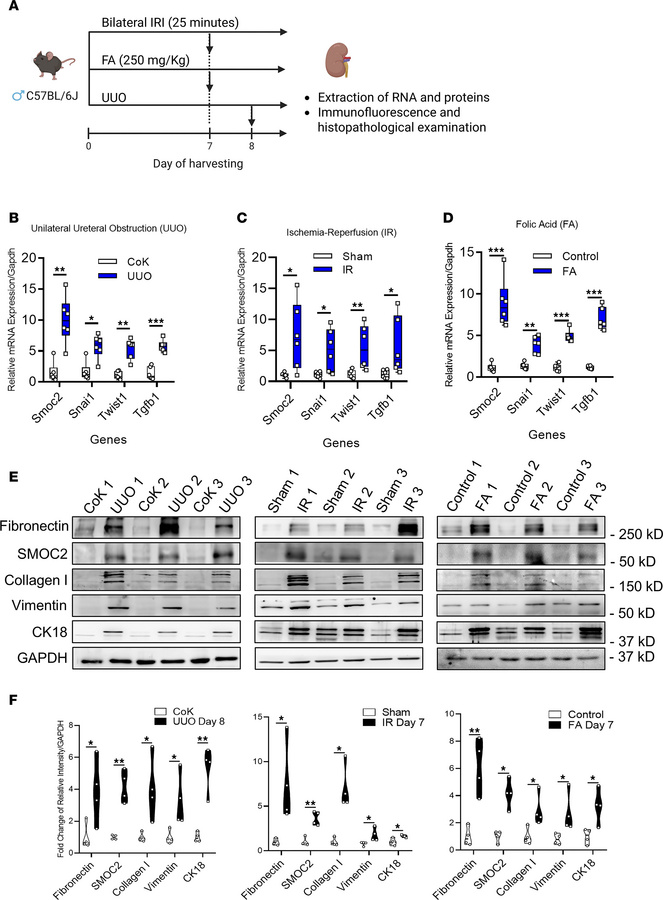SMOC2 upregulation is concomitant with pEMT, injury, and fibrotic marker...