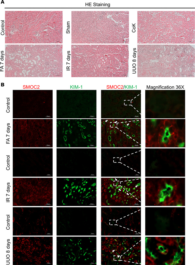 SMOC2 is localized at the tubular epithelium basement membrane and coloc...