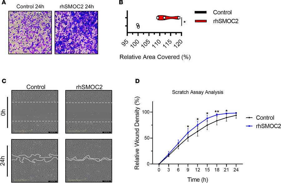 Recombinant SMOC2 increases the motility of proximal tubular epithelial ...