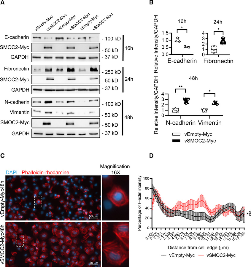 Ectopic expression of SMOC2 induces the pEMT properties of proximal tubu...