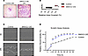 Ectopic expression of SMOC2 increases the motility of proximal tubular epit