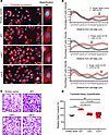 The extracellular calcium binding and the follistatin domains of SMOC2 cont