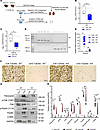 SMOC2 regulates integrin signaling and pEMT in mice undergoing UUO.