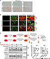 SMOC2 promotes an epithelial-fibroblast crosstalk during fibrogenesis.