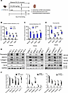 SMOC2 upregulation is concomitant with pEMT, injury, and fibrotic markers i