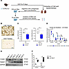 Injured tubules after UUO undergo pEMT and significantly contribute to Smoc