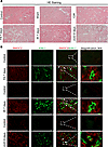 SMOC2 is localized at the tubular epithelium basement membrane and colocali