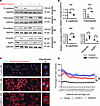 Recombinant SMOC2 stimulates the pEMT properties of proximal tubular epithe