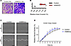 Recombinant SMOC2 increases the motility of proximal tubular epithelial cel