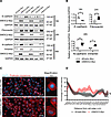 Ectopic expression of SMOC2 induces the pEMT properties of proximal tubular
