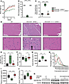In a mouse model of XLMTM (MTM1–/y), the presence of the PIK3C2B kinase-dea