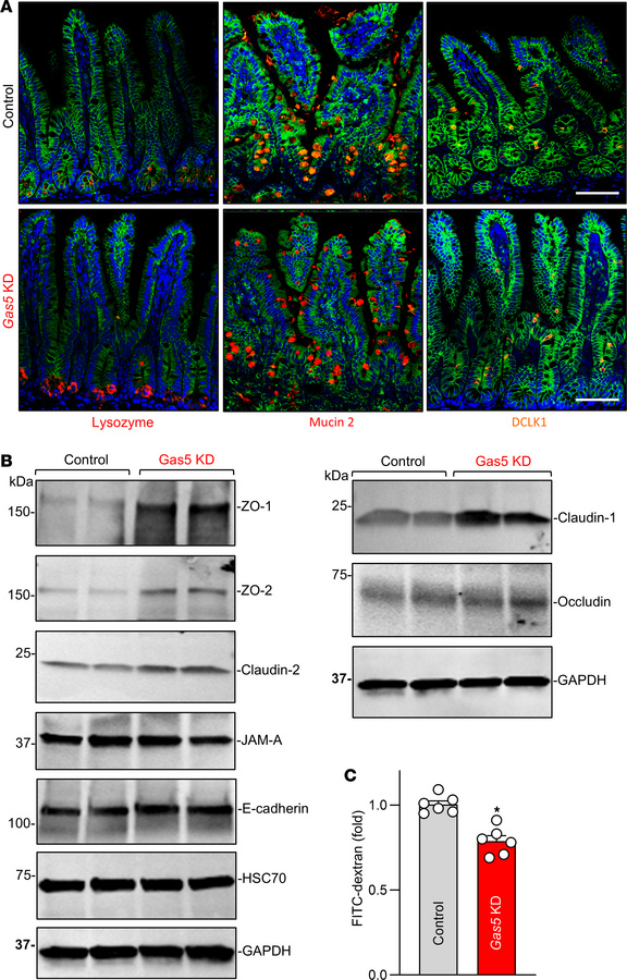 Decreasing the levels of Gas5 increases Paneth cells and improves gut ba...