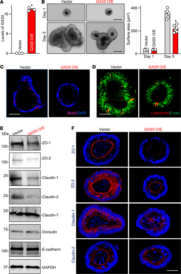 Ectopic overexpression of Gas5 inhibits enteroid growth and decreases ti...