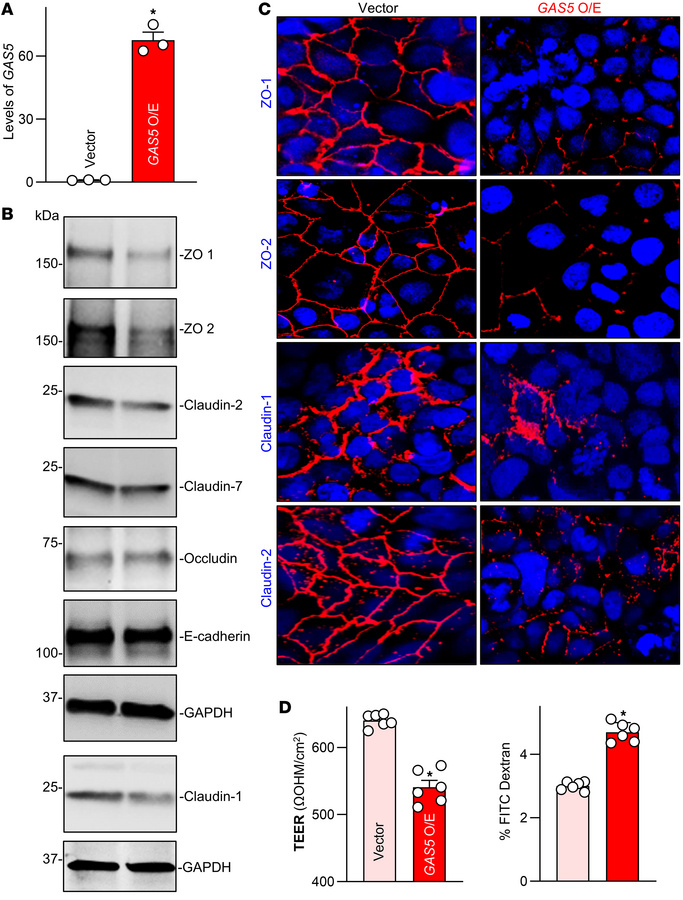 Ectopically expressed GAS5 disrupts intestinal epithelial barrier functi...