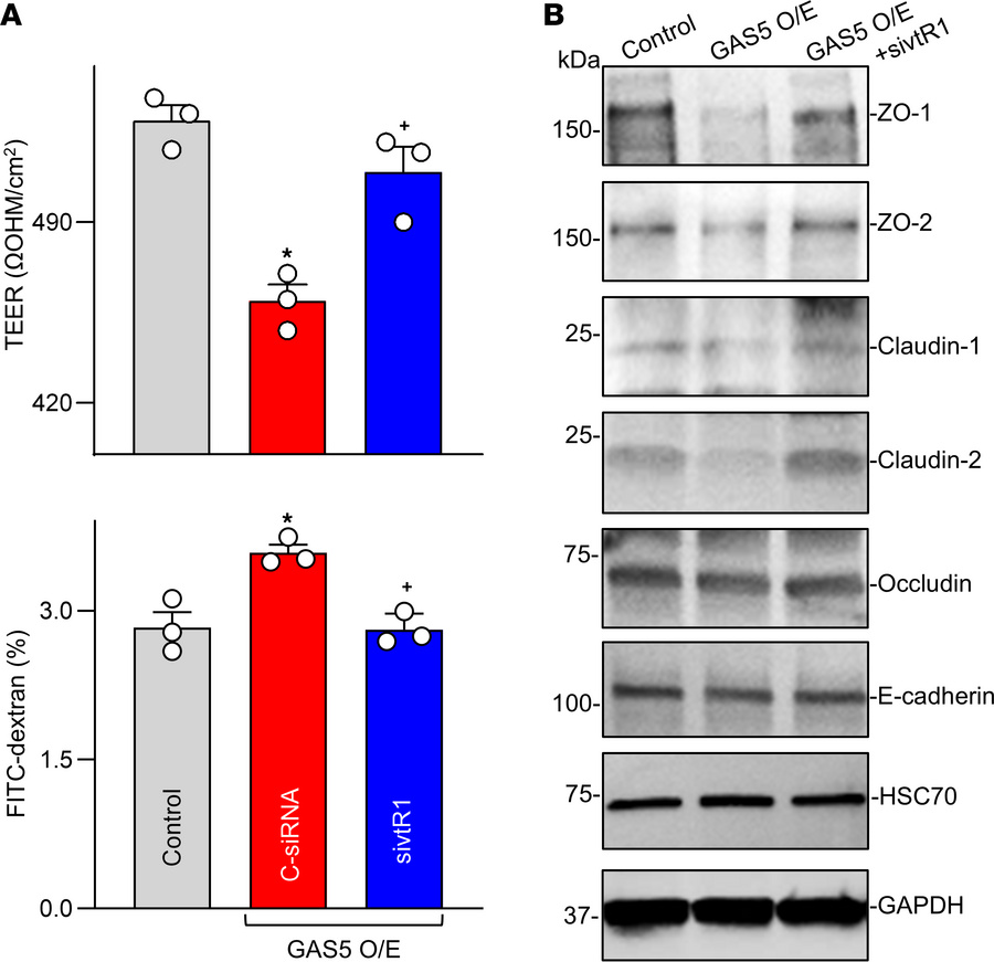 
vtRNA1-1 silencing prevents GAS5-induced epithelial barrier dysfunction...