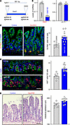 Targeted deletion of the Gas5 by CRISPR/Cas9 in mice enhances renewal of th