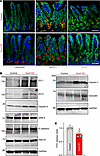 Decreasing the levels of Gas5 increases Paneth cells and improves gut barri