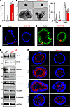 Ectopic overexpression of Gas5 inhibits enteroid growth and decreases tight