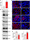 Ectopically expressed GAS5 disrupts intestinal epithelial barrier function