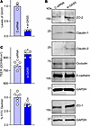 GAS5 silencing improves intestinal epithelial barrier function in culture.