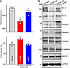 vtRNA1-1 silencing prevents GAS5-induced epithelial barrier dysfunction in