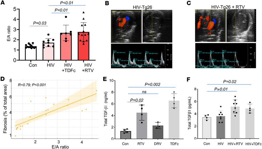 Effect of ART on cardiac function in HIV-Tg26 mice.
(A) Bar plot showing...