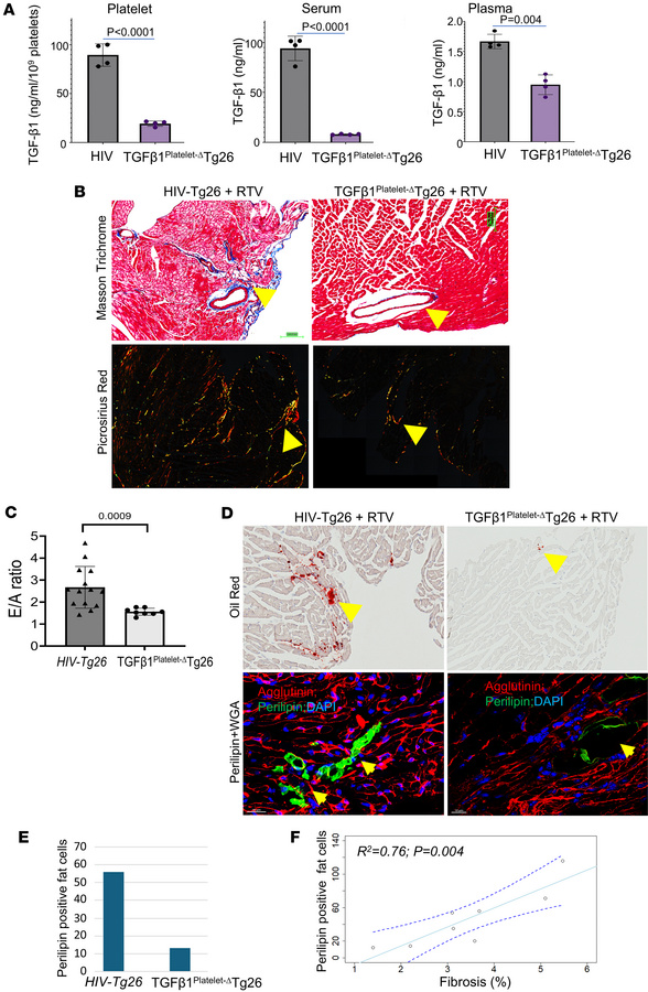 TGF-β1Platelet-ΔTg26 mice are partially protected from developing RTV-in...