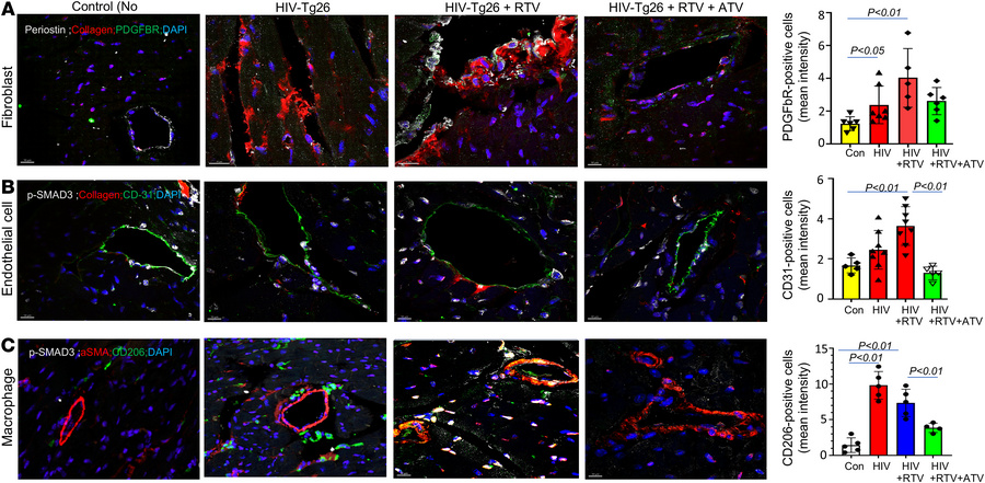 Atorvastatin inhibits SMAD signaling and mesenchymal transition in the h...