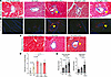 Effect of ART on cardiac fibrosis in HIV mice.
