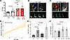 Effect of ART on cardiac function in HIV-Tg26 mice.