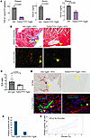 TGF-β1Platelet-ΔTg26 mice are partially protected from developing RTV-induc