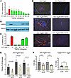 Atorvastatin suppresses TGF-β1 signaling, cardiac fibrosis, and fat cell de