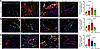 Atorvastatin inhibits SMAD signaling and mesenchymal transition in the hear
