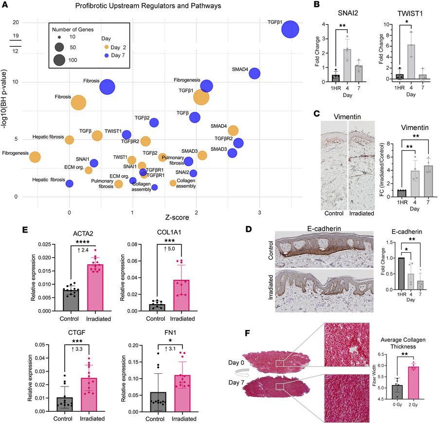 Induction of EMT and profibrotic genes in irradiated ex vivo skin.
(A) B...